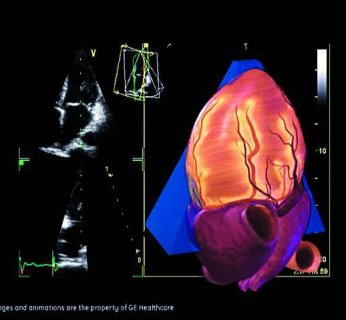 Oprogramowanie GE Global Research, czyli Człowiek Biotyczny