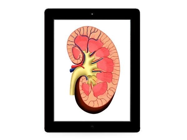 Nerka za iPada, a teraz olbrzymie kłopoty zdrowotne