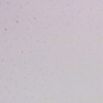 Fragmenty zdjęć z widocznymi na nich efektami powodowanymi przez zabrudzenia matrycy.