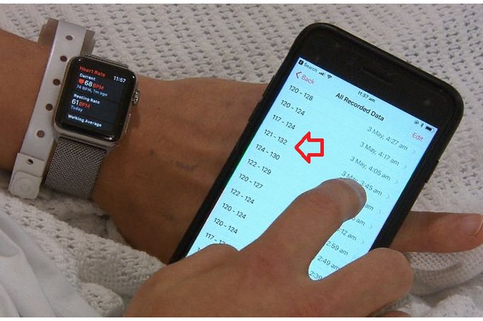 apple watch