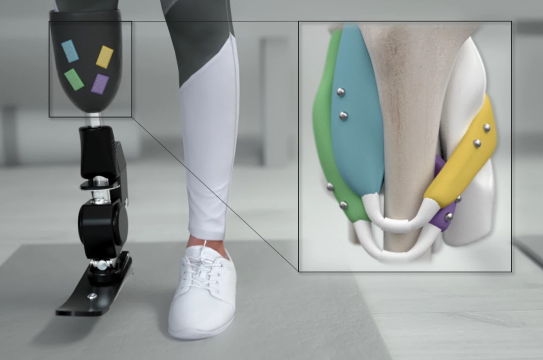 Magnetyzm przyszłością dla nowoczesnych protez? Naukowcy z MIT znaleźli alternatywę dla elektrod