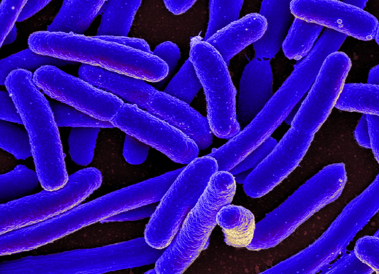 Tak bakterie naprawiają uszkodzone DNA. Czy podobna metoda pomoże ludziom?