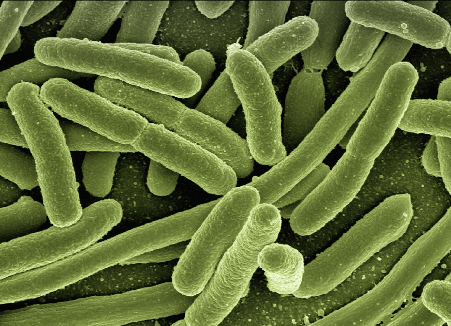 Genom Escherichia coli znaleziony w 400-letniej mumii. Niesamowite źródło patogenu